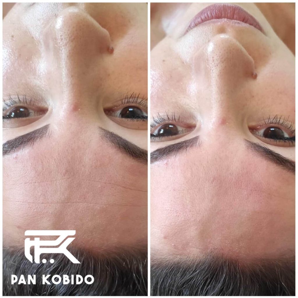 effect of Kobido Face Massage